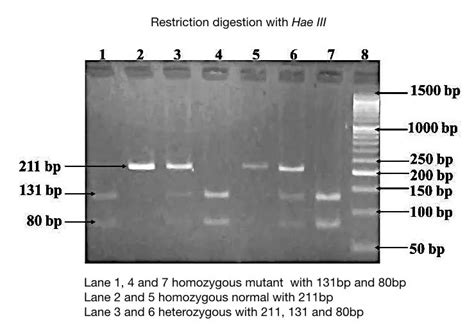 Agarose Gel Electrophoresis: Results Analysis.